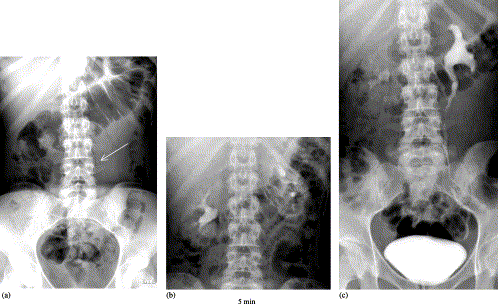 Uroradiology