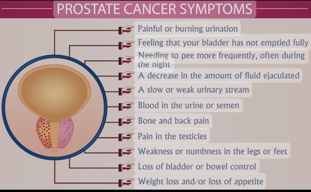 Prostate Cancer Symptoms