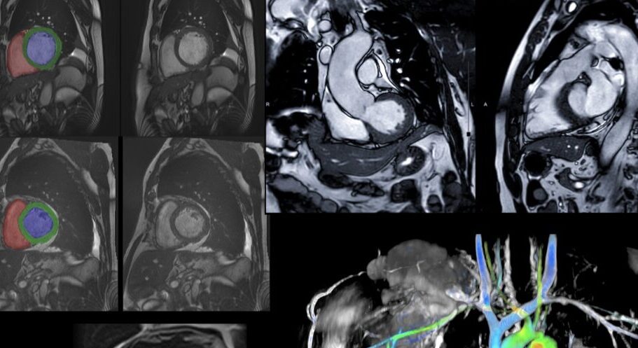 ECHO-CARDIOGRAPHY